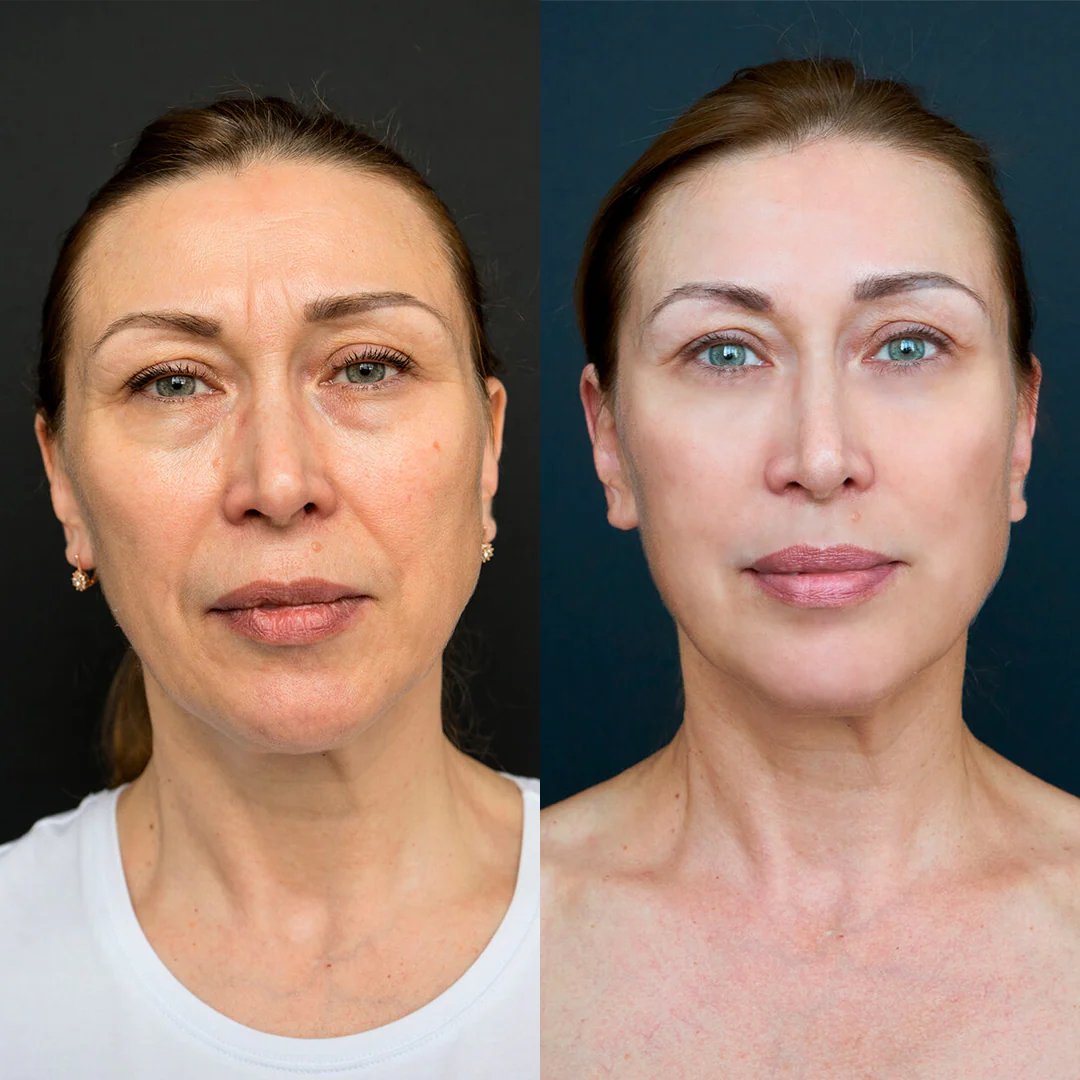 Elevate Moisturizer - Image 7