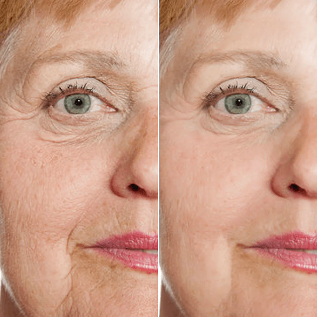 Rejuvenate Resurfacing Face Serum (3 Pack) - Image 4