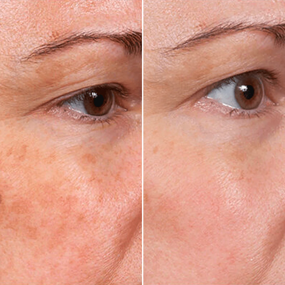 Rejuvenate Resurfacing Face Serum (3 Pack) - Image 5